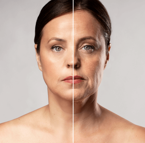 Clínica Hartmann Endolift Endolaser Salvador